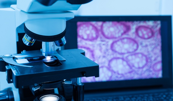 Digital Pathology Presents a Great Opportunity for India